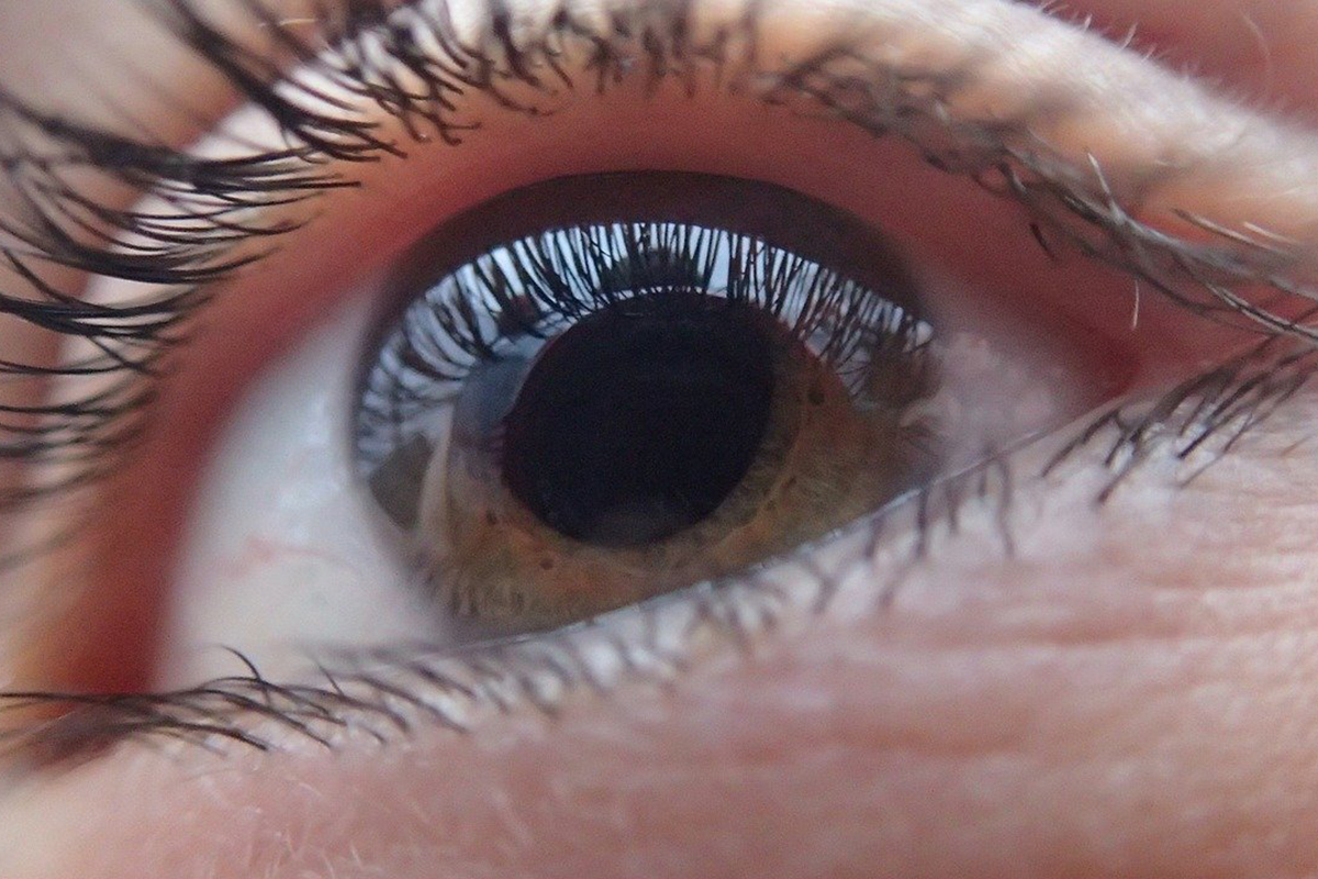 La inteligencia artificial revolucionará la detección temprana del glaucoma