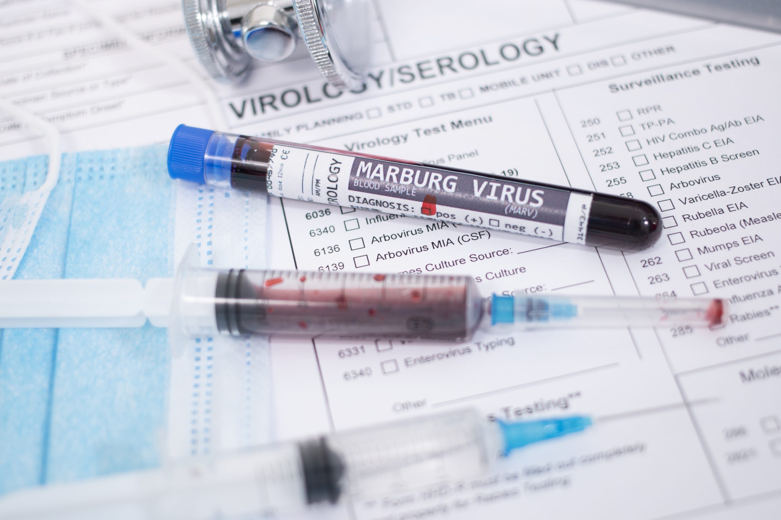 Fármaco probado en animales podría ser eficaz para hacer frente al virus de Marburgo: OMS