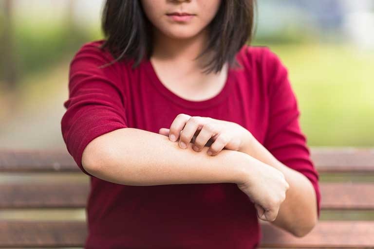 Tres de cada diez adolescentes mexicanos padecen dermatitis atópica&#8230; ¿En qué consiste?