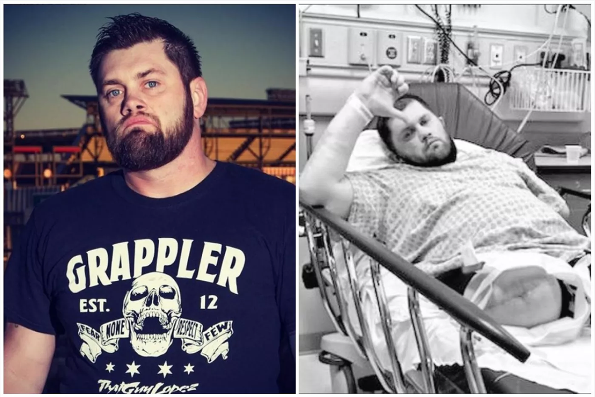 Infección por SARM: ¿qué es y por qué obligó a que al luchador Jimmy Rave le amputaran las piernas?