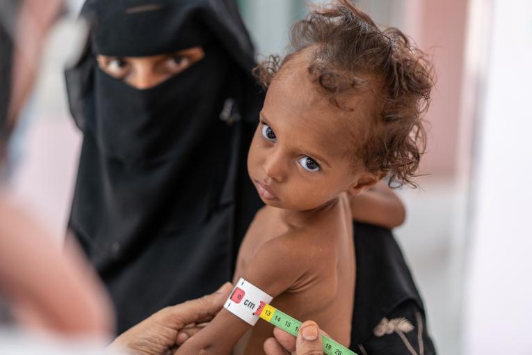 Yemen: 10,000 niños han sido asesinados o mutilados y 400,000 sufren desnutrición aguda grave