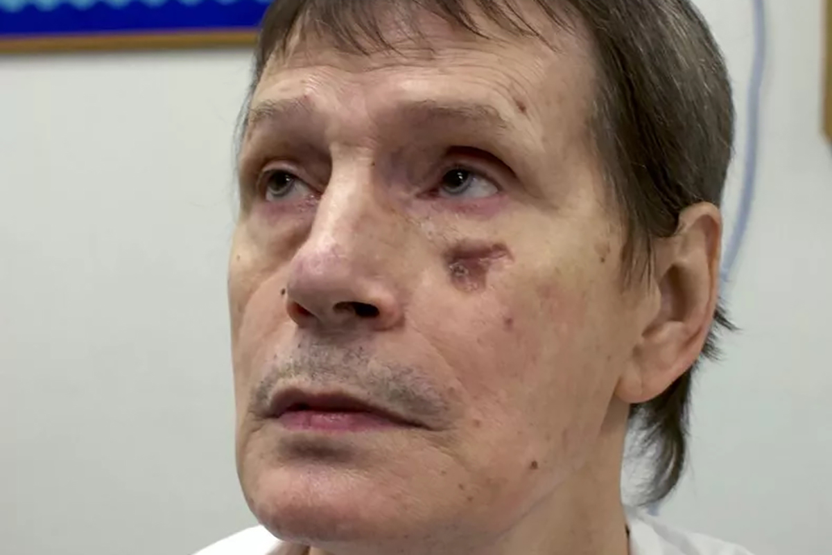 Hombre cuya pena capital fue detenida por problemas en las venas muere de cáncer