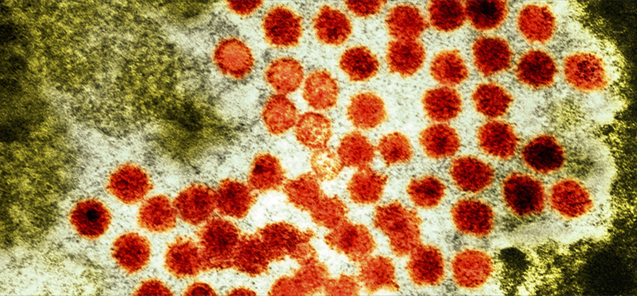 Una muerte y 17 trasplantes de hígado en menores por hepatitis de origen desconocido: OMS