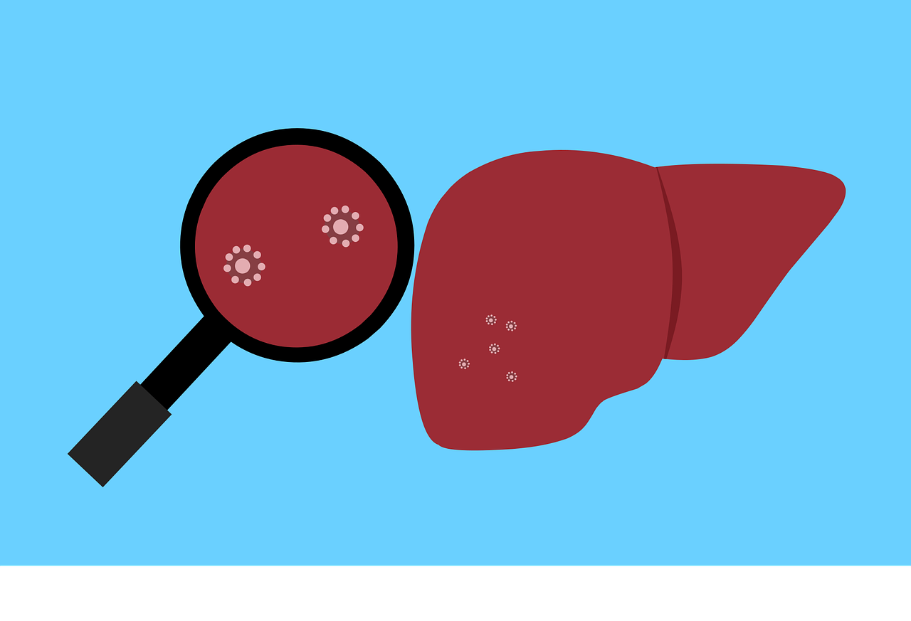 OMS contabiliza 348 casos de misteriosa hepatitis en 20 países