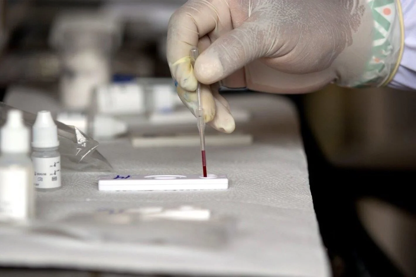 OPS presenta nuevas orientaciones en investigación de hepatitis de origen desconocido