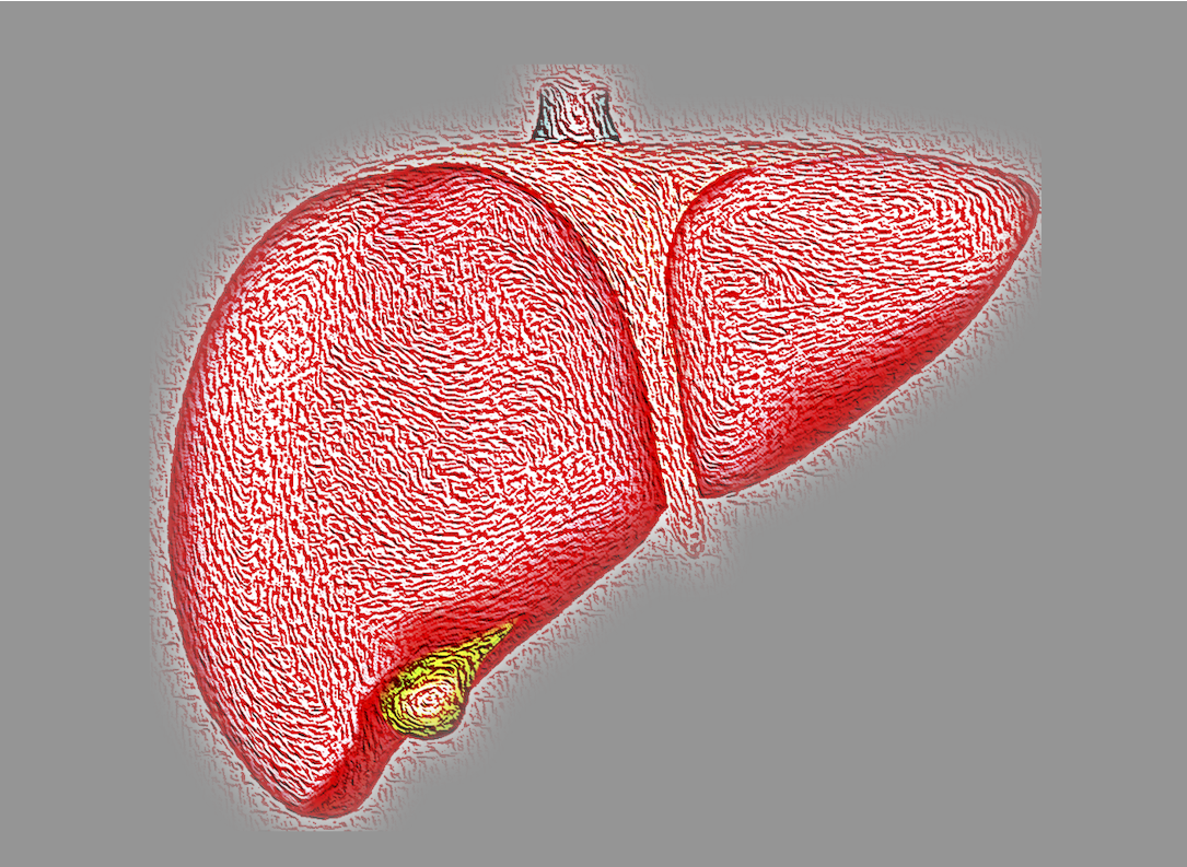 En el mundo hay más de 1,000 casos de hepatitis aguda grave en niños: OMS