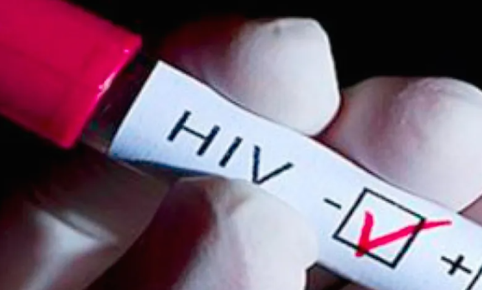 Detectan a cuatro personas con VIH en Hidalgo, en solo una semana