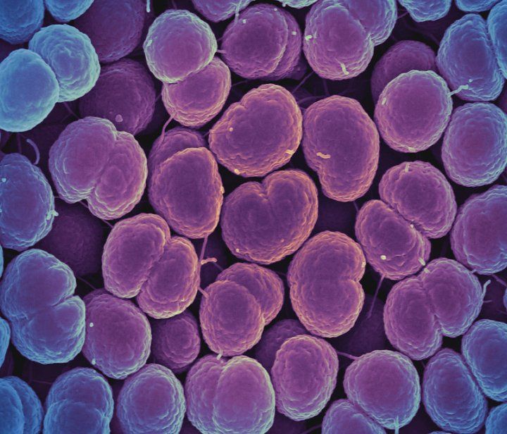 Doxiciclina