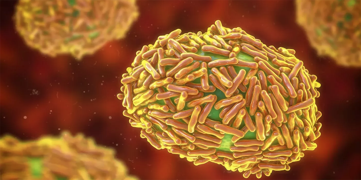 La viruela símica sobrevive en el agua, alimentos y superficies durante semanas