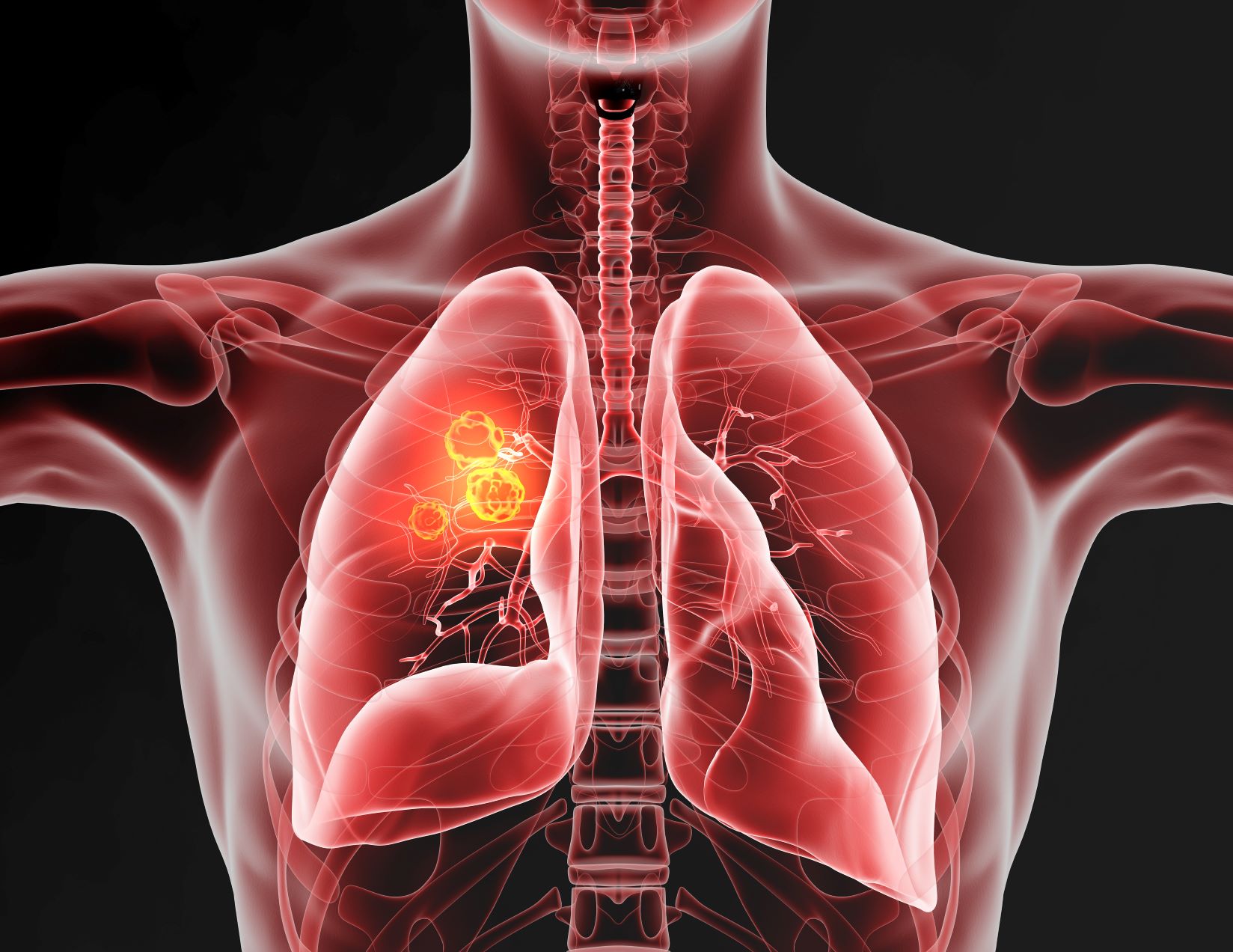 El cambio climático así afecta a los pulmones
