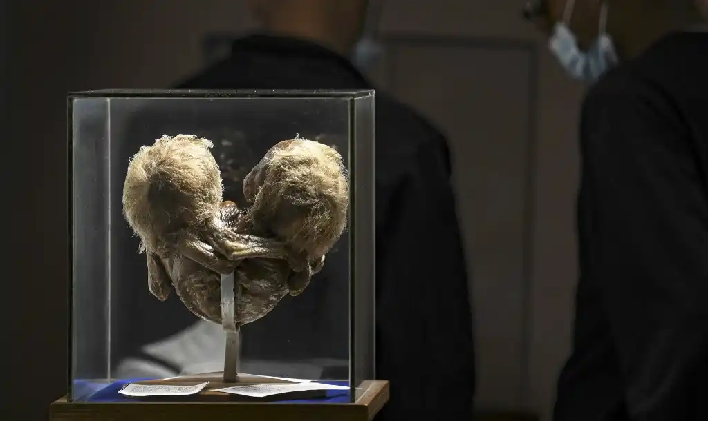 Cerebros disecados y bustos momificados, algunas de las piezas del Museo del Ser Humano