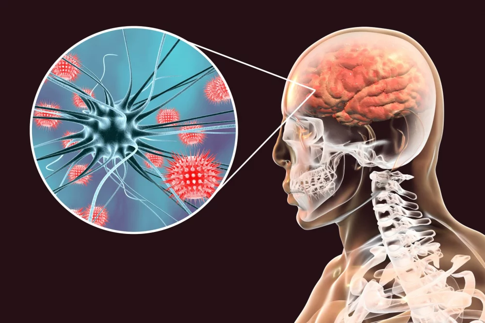 Meningitis: qué está haciendo Durango para combatirla
