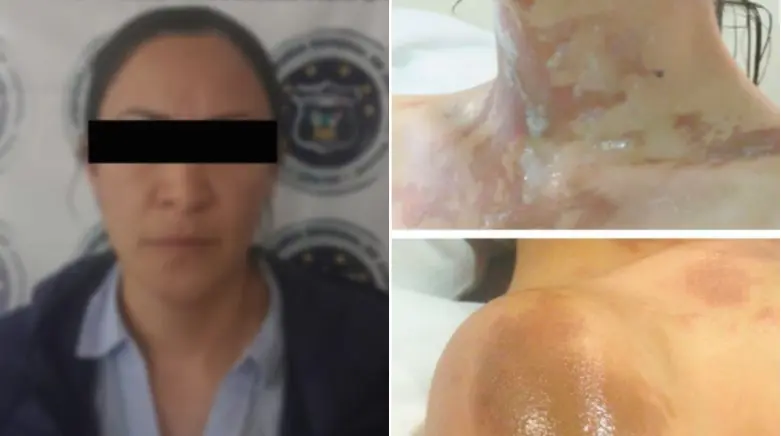 Detienen a mujer que mandó a atacar con ácido a Lesli