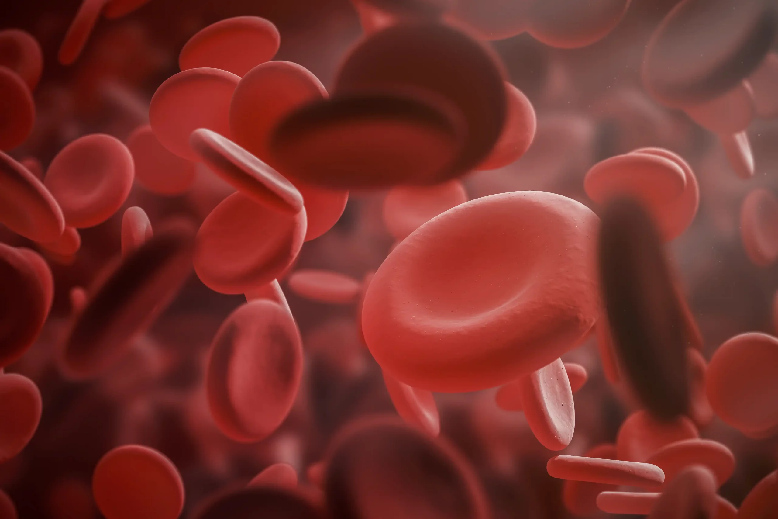 Anemia