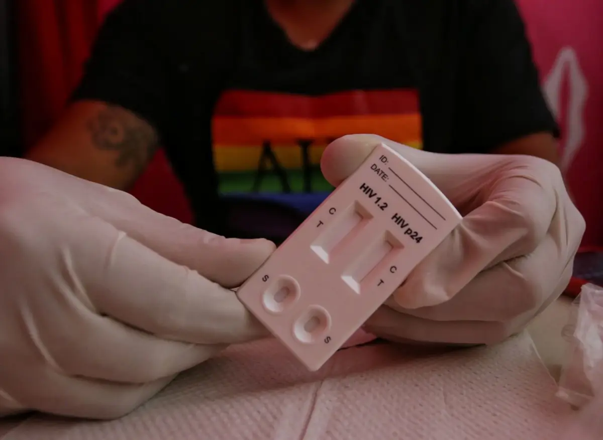 En México existen 1,521 centros de atención con acceso a tratamiento para VIH y hepatitis