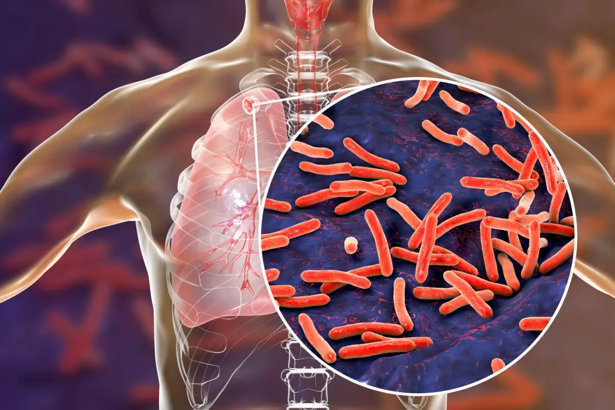Muertes tuberculosis