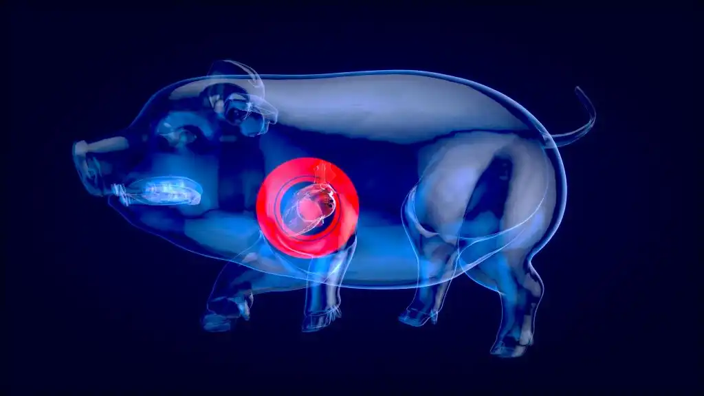 Segunda persona en recibir un trasplante de cerdo muere seis semanas después