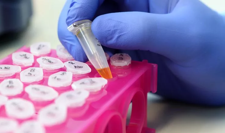 ¿Es la IA la herramienta para combatir el cáncer que estábamos esperando?