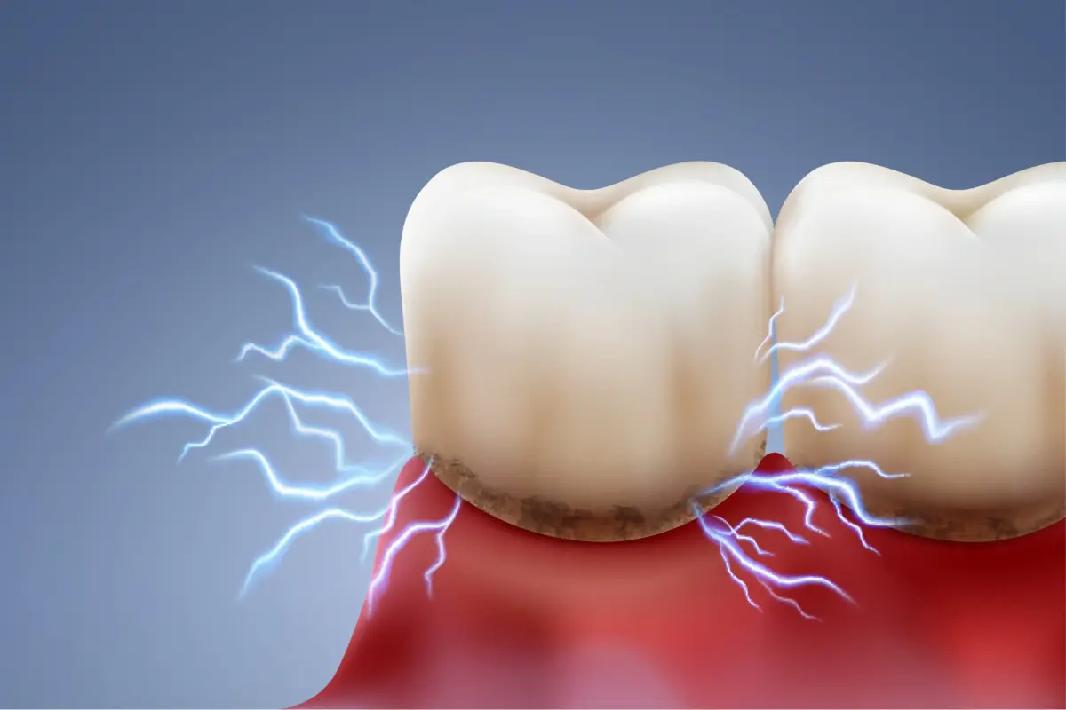 El hallazgo de canales iónicos abre la puerta al tratamiento del dolor dental
