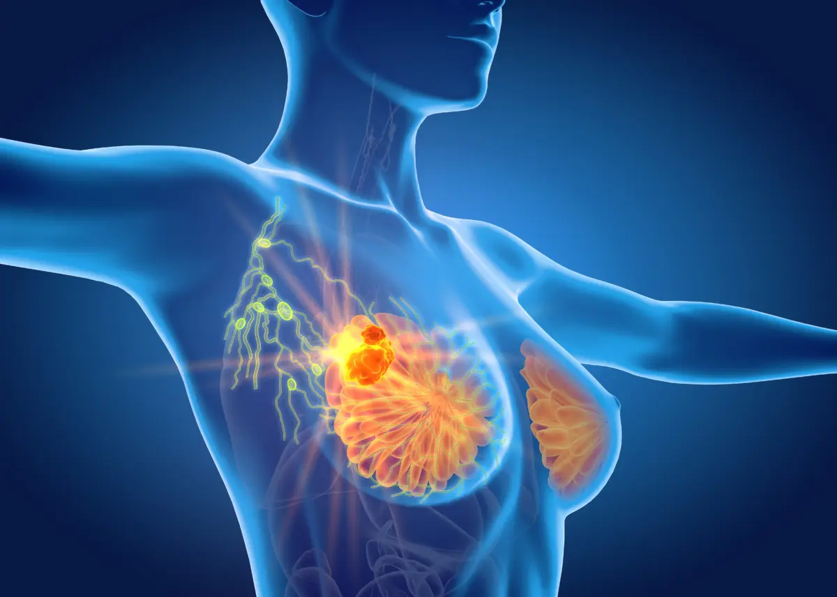 900 químicos relacionados con el cáncer de mama se hallan en alimentos y medicinas
