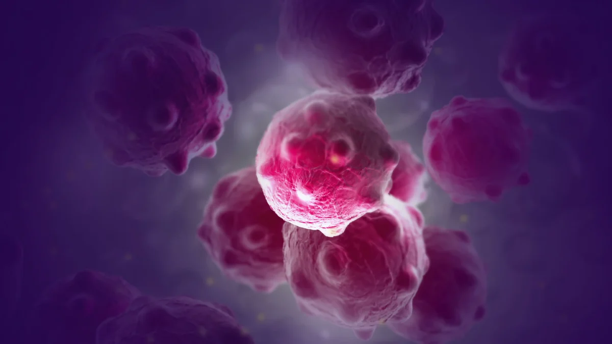 Una de cada cinco personas desarrolla cáncer; en 2050 los casos aumentarán 77 por ciento