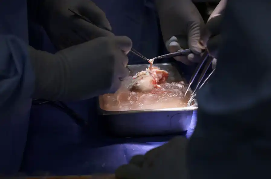 Hito médico: riñón de cerdo modificado genéticamente salva una vida humana