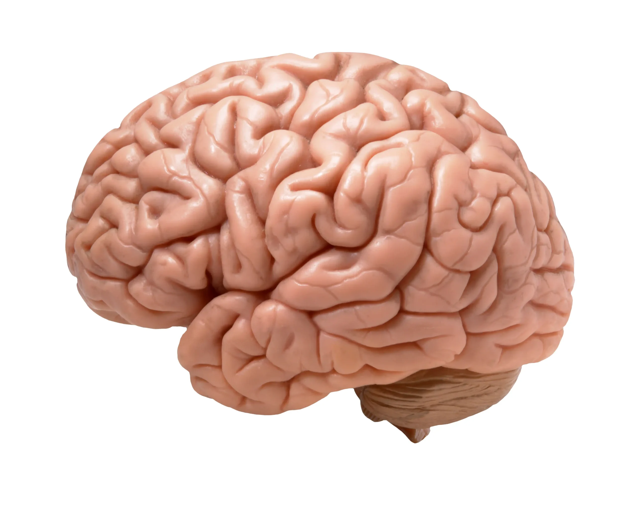 Aguja cerebro