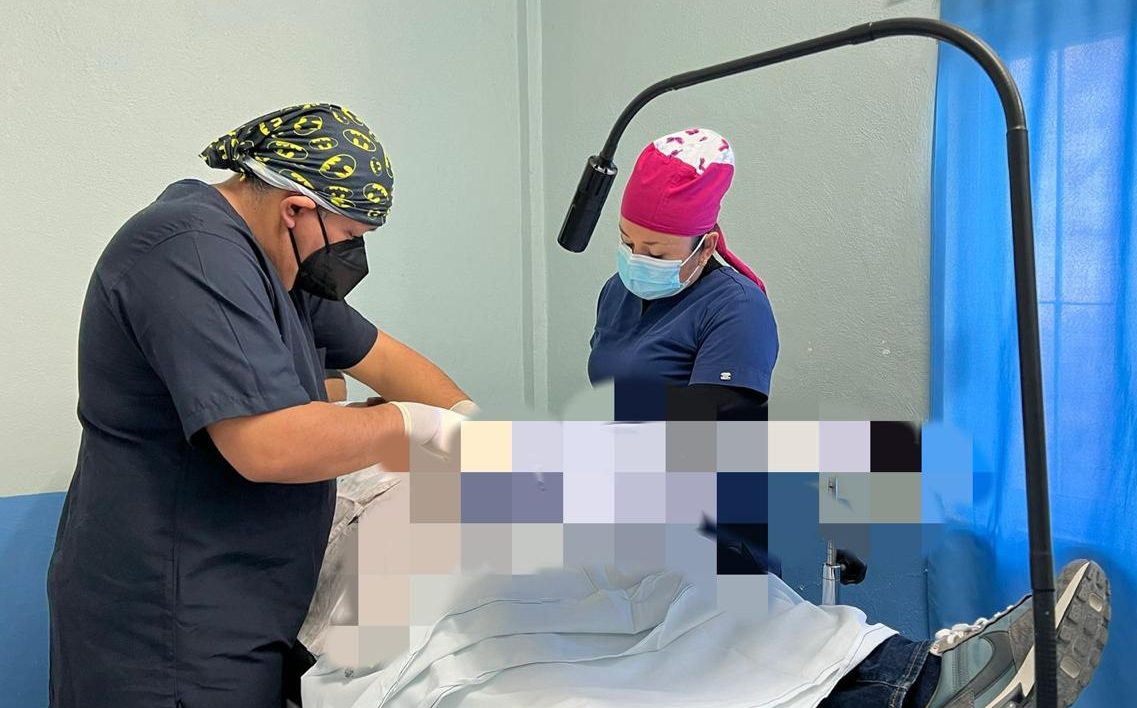 Vasectomía sin bisturí oportunidad de salud masculina