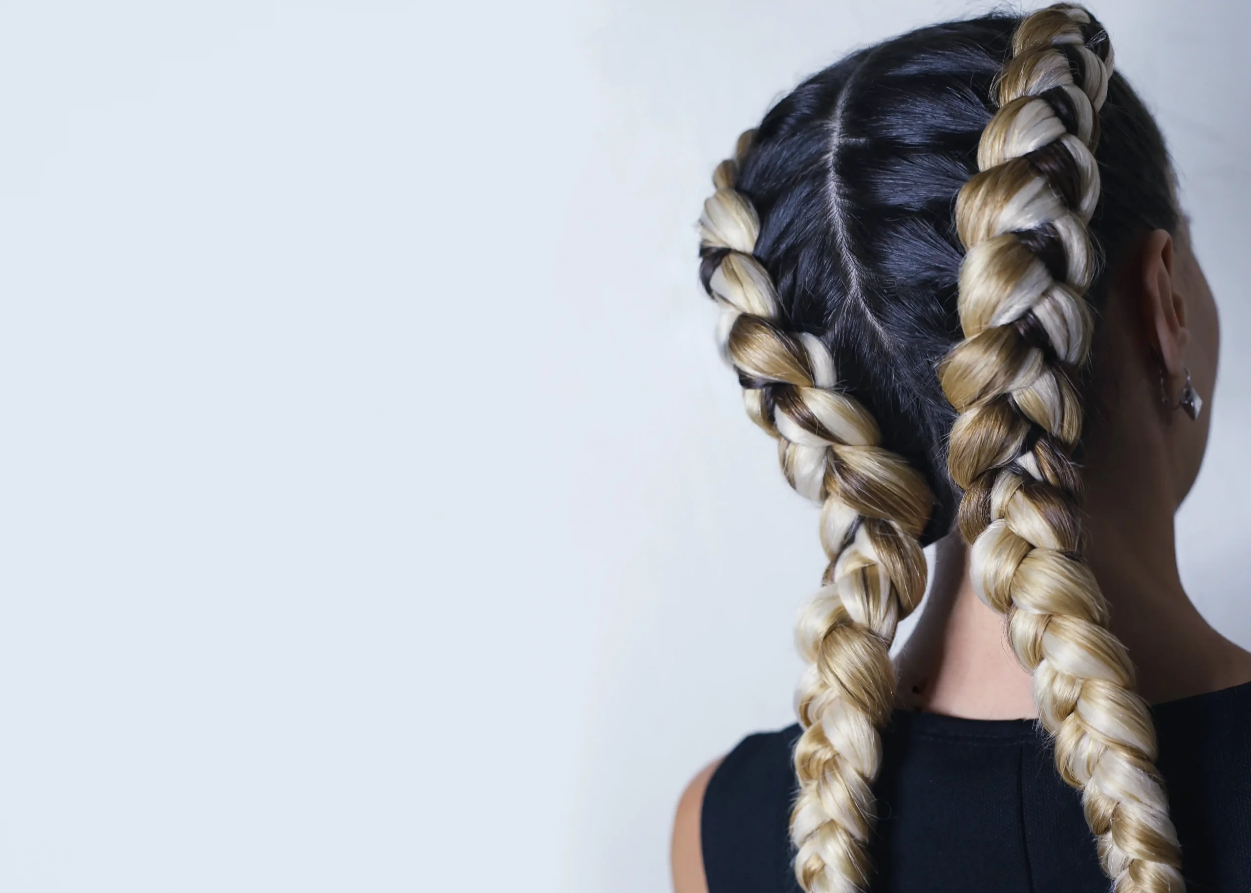 alopecia peinados