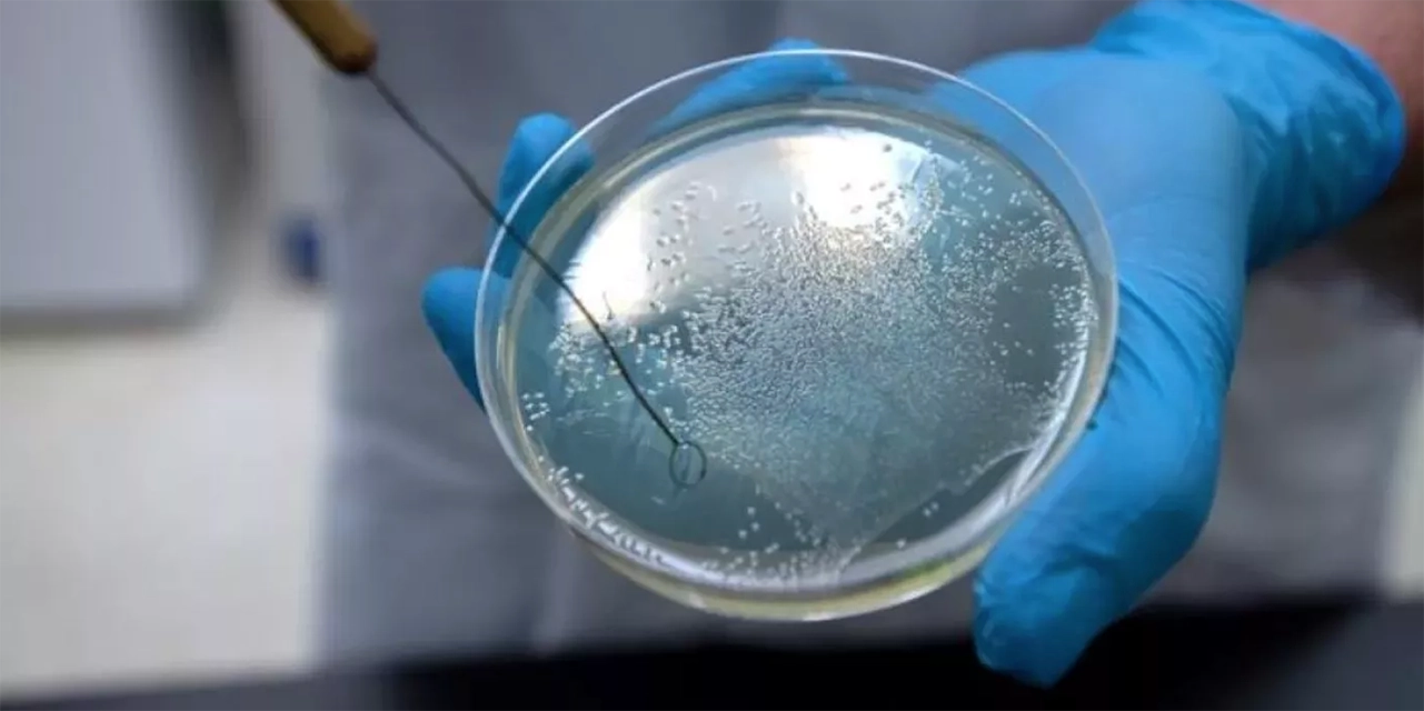 bacterias sangre