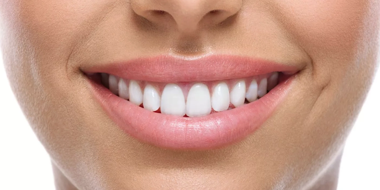 dientes blancos