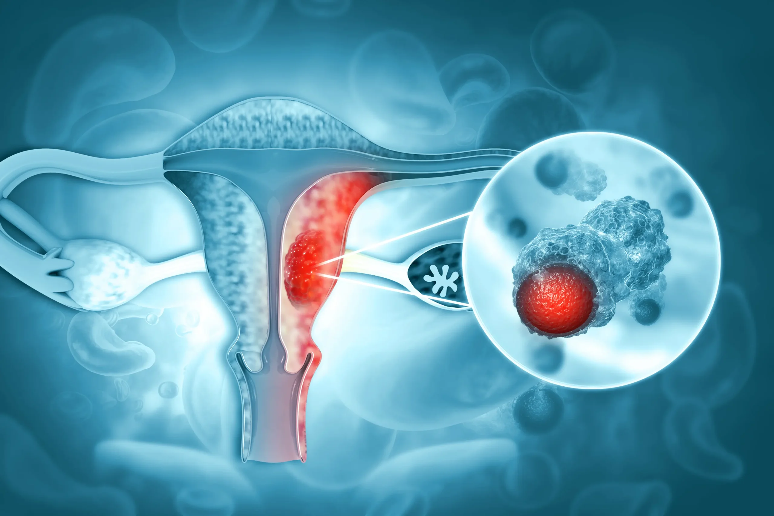 Cada dos minutos muere una mujer de cáncer de cuello uterino