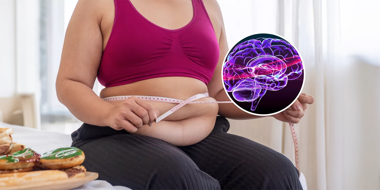 Neurocientíficos advierten que la grasa abdominal puede incrementar el riesgo de alzhéimer