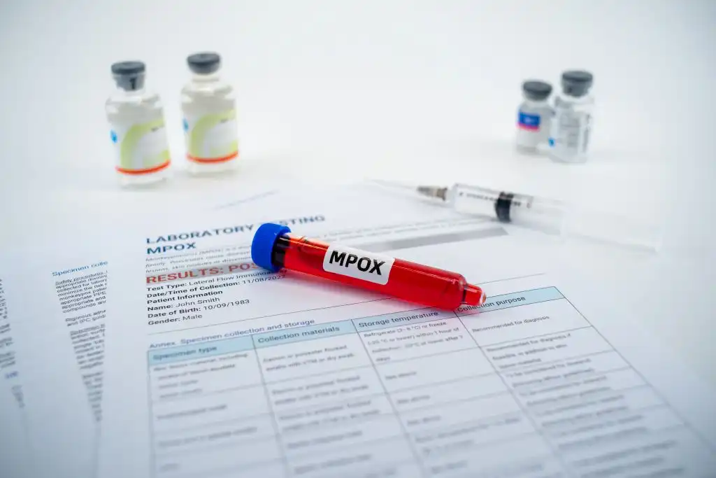 La OMS autoriza la primera prueba rápida para detectar la enfermedad de mpox