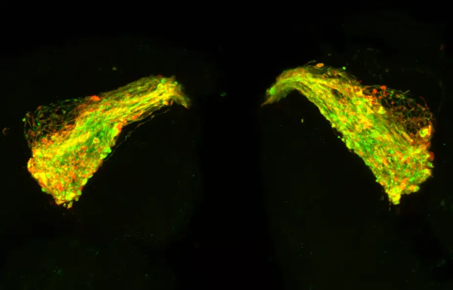 Científicos desarrollan el &#8216;primer&#8217; tratamiento que promete detener la neurodegeneración del alzhéimer