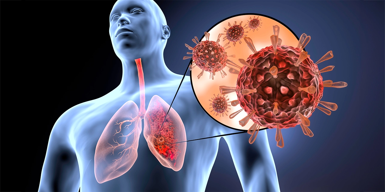infecciones respiratorias