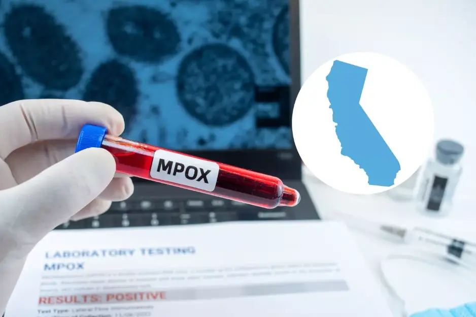 Cepa mpox