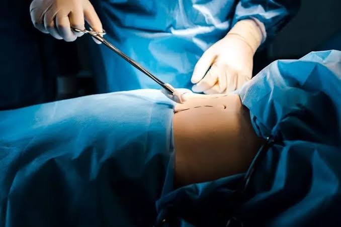 Siguen en prisión acusados de realizar procedimientos de liposucción sin certificación