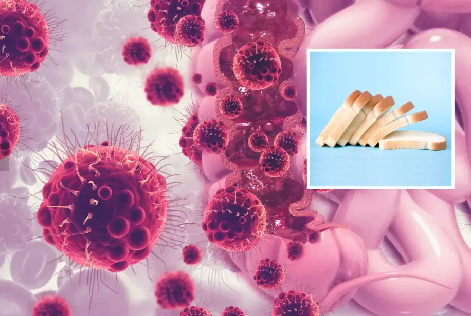 Alimentos comunes que pueden provocar cáncer de colon