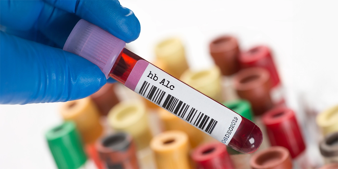 Mitos y realidades sobre el azúcar en la sangre: lo que los expertos quieren que sepas