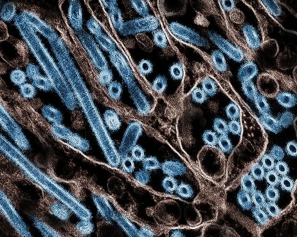 EUA reporta la primera muerte humana a causa de la gripe aviar