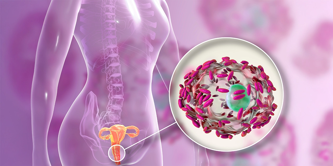 vaginosis bacteriana