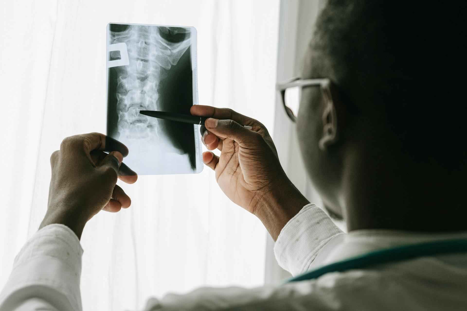 Accidentes traumatológicos: los que más incapacidades laborales provocan