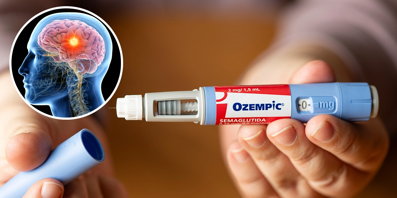El Ozempic, un fármaco para bajar de peso, tiene el potencial de reducir los riesgos de demencia