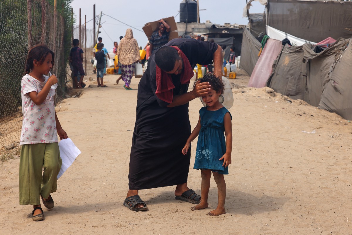 Israel asegura que no hay &#8220;desnutrición generalizada&#8221; en Gaza