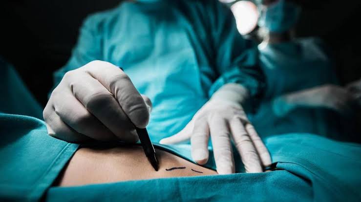 #LeyNicole: buscan regular procedimientos estéticos en menores de 18 años