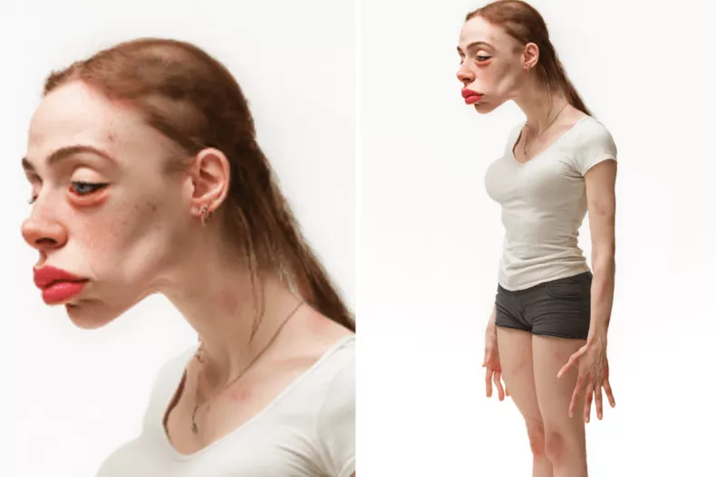 Así luciría un influencer en 2050: mala postura, dermatitis y fatiga visual