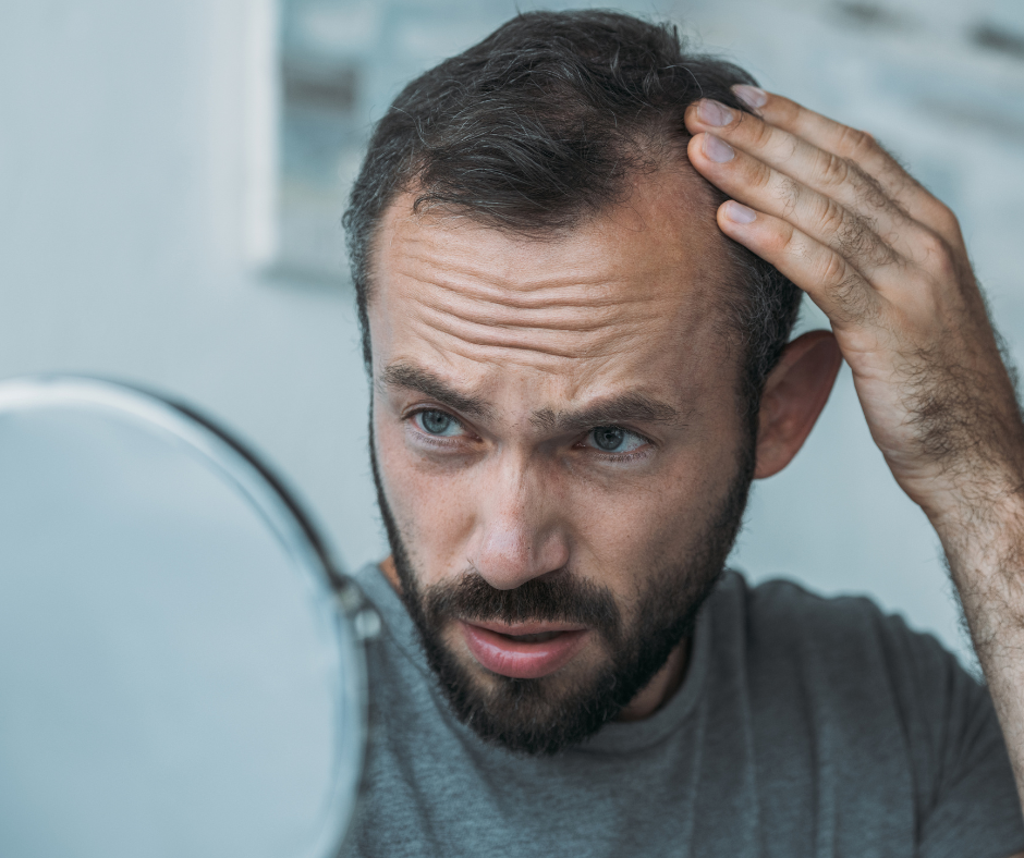 La caída de cabello está ligada a tu alimentación
