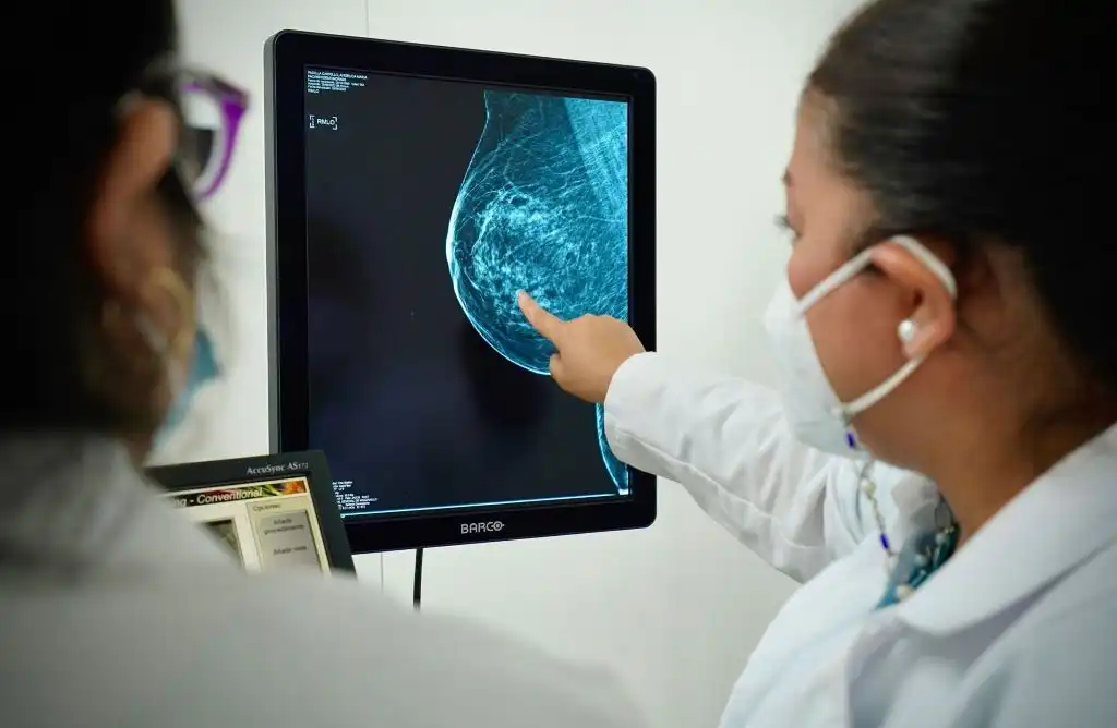 Pacientes con cáncer de mama deberían evitar estas dietas altas en grasa, advierten científicos