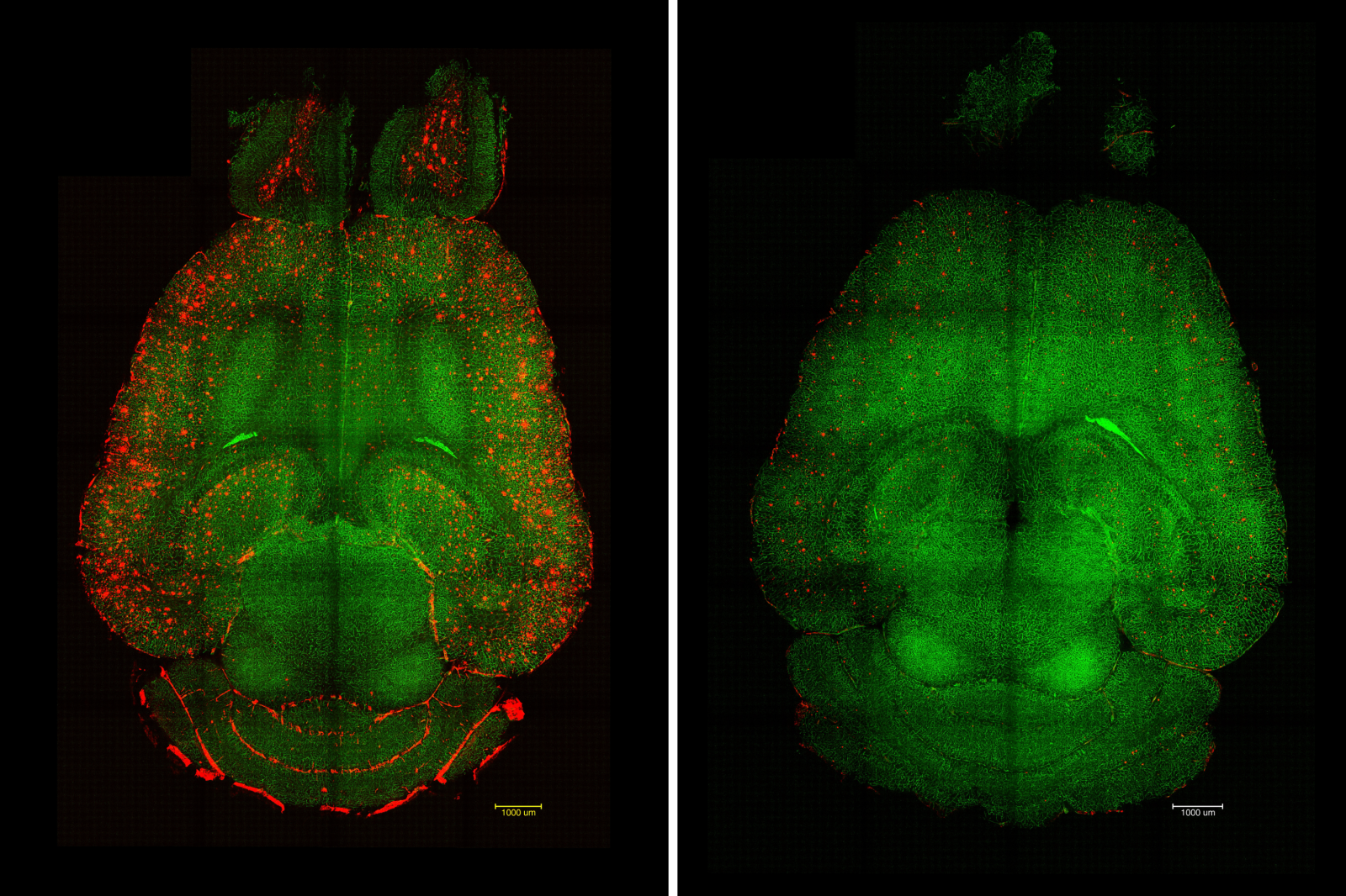 Nanotecnología que repara el cerebro: una nueva terapia revierte el alzhéimer en ratones